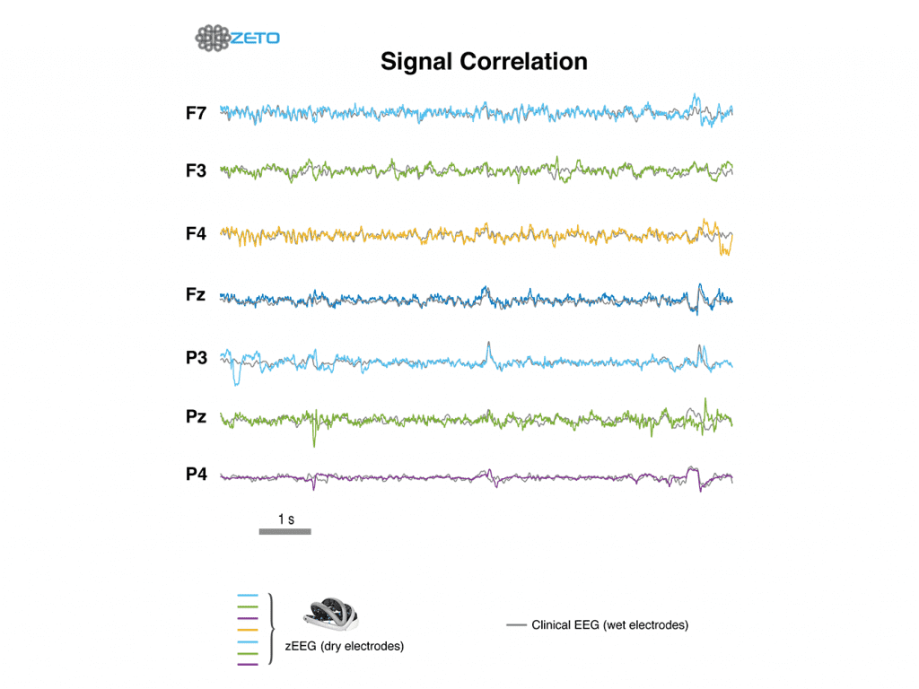 Zeto Dry EEG Headset Signal Correlation