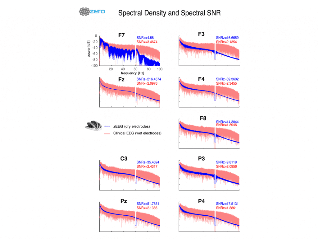 Zeto Dry EEG Headset Spectral Density and Spectral SNR