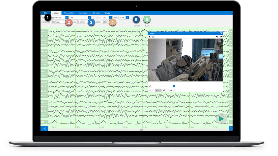 Zeto Brain Wave Monitoring Device Cloud Platform