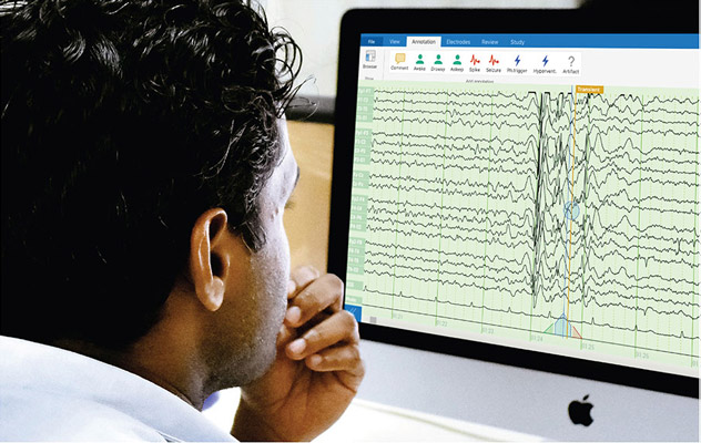 EEG Technologist reviewing an EEG chart