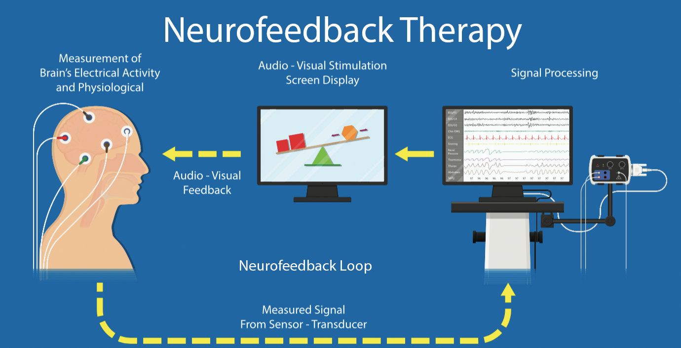 Neurofeedback EEG