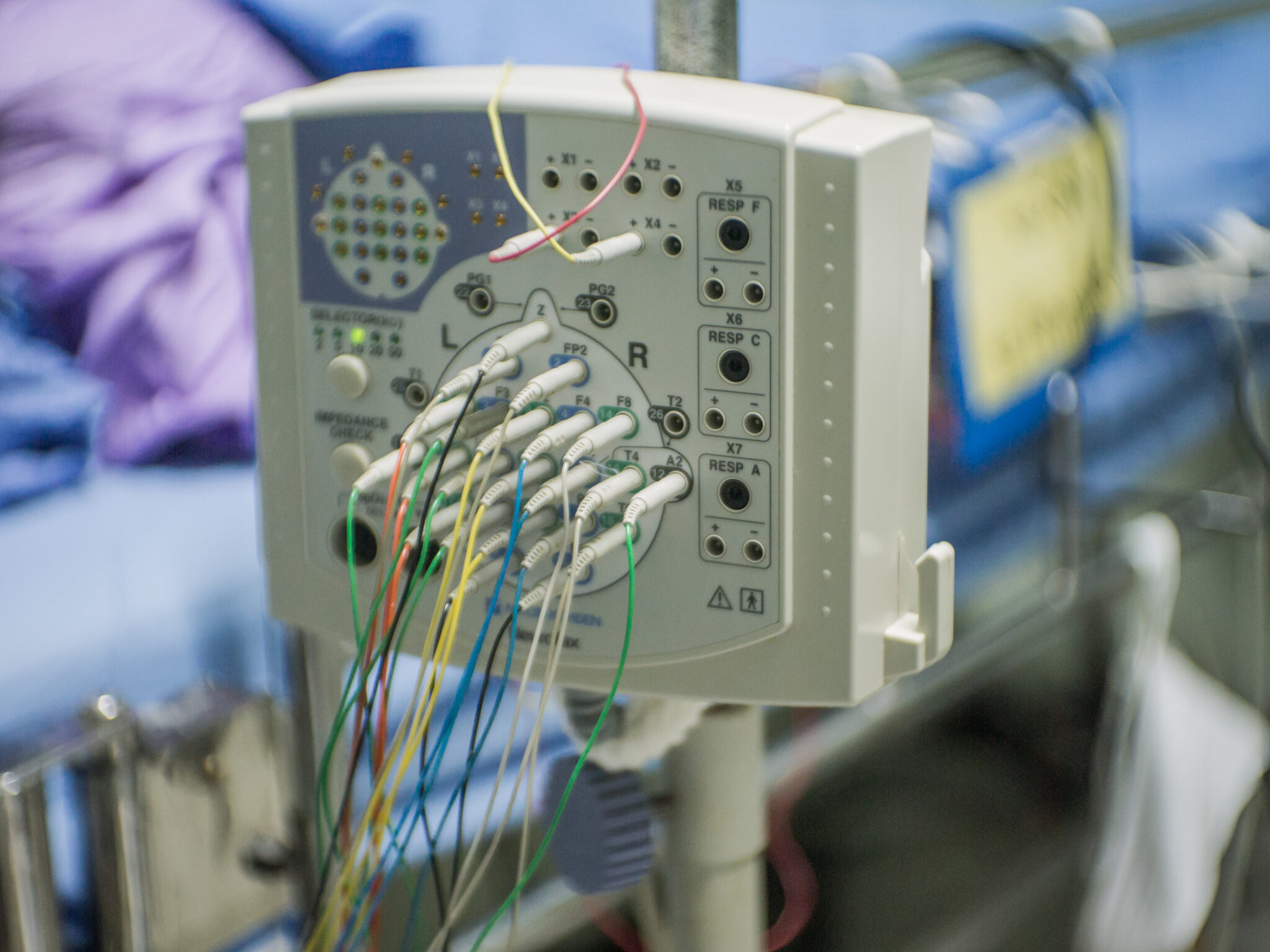 EEG in the ICU: Brain Monitoring in ICU and ED | Zeto EEG