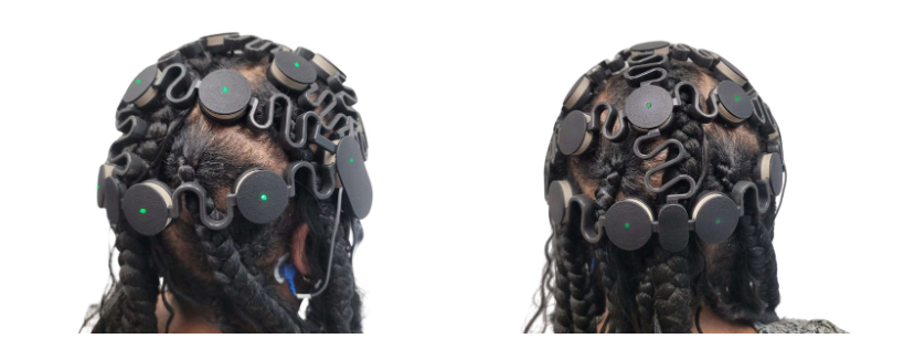 Zeto offers EEG solution for protective hairstyles