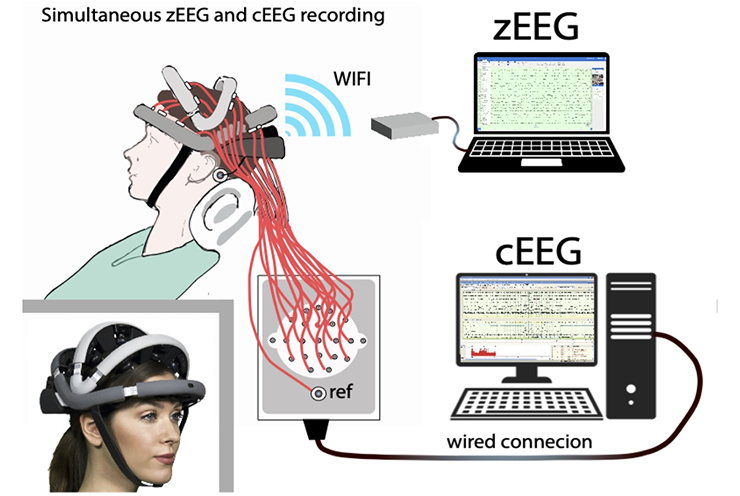 Signal Quality of Zeto EEG Headsets Proven Equivalent to Conventional EEG